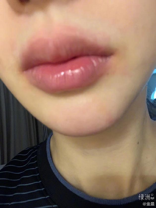 金晨用杜華送的螺螄粉豐唇怎么回事?聊天記錄曝光網(wǎng)友發(fā)現(xiàn)這個(gè)細(xì)節(jié)