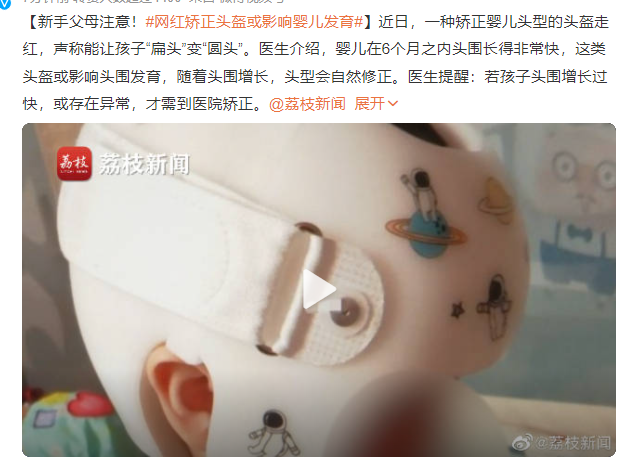 不要盲目跟風(fēng)!醫(yī)生:網(wǎng)紅矯正頭盔或影響嬰兒發(fā)育